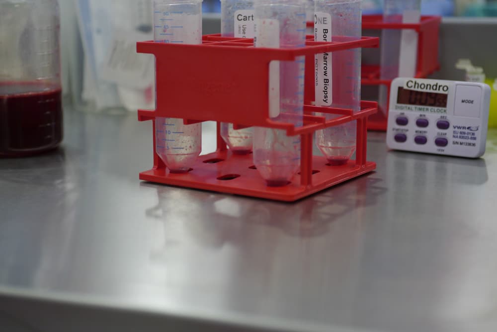 Cartilage cells cultured in the laboratory at London Cartilage Clinic